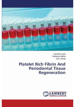 Platelet Rich Fibrin And Periodontal Tissue Regeneration