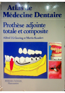 Prothèse adjointe totale et composite