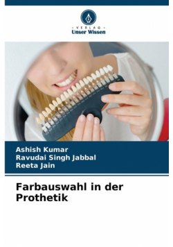 Farbauswahl in der Prothetik