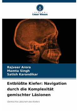 Entblößte Kiefer