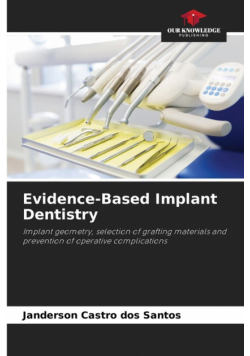 Evidence-Based Implant Dentistry