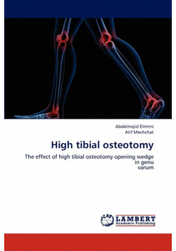 High tibial osteotomy