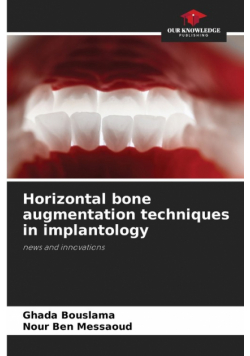 Horizontal bone augmentation techniques in implantology