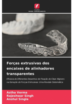 Forças extrusivas dos encaixes de alinhadores transparentes