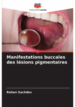 Manifestations buccales des lésions pigmentaires