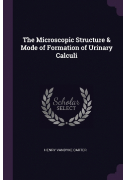 The Microscopic Structure & Mode of Formation of Urinary Calculi