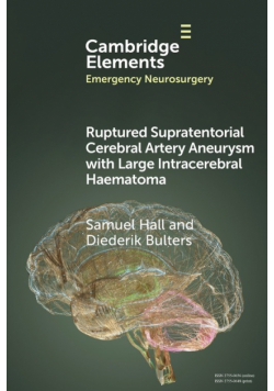 Ruptured Supratentorial Cerebral Artery Aneurysm with Large Intracerebral Haematoma