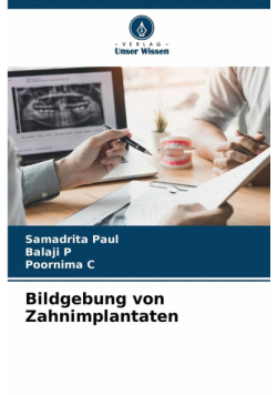 Bildgebung von Zahnimplantaten