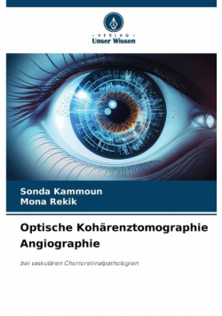 Optische Kohärenztomographie Angiographie
