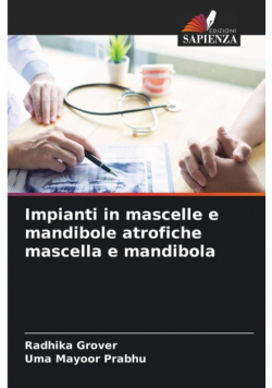 Impianti in mascelle e mandibole atrofiche mascella e mandibola