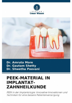 Peek-Material In Implantat-Zahnheilkunde