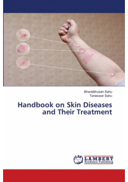 Handbook on Skin Diseases and Their Treatment