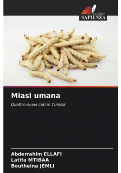 Miasi umana