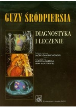 Guzy śródpiersia. Diagnostyka i leczenie