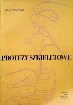 Protezy szkieletowe