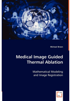 Medical Image Guided Thermal Ablation