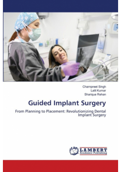 Guided Implant Surgery