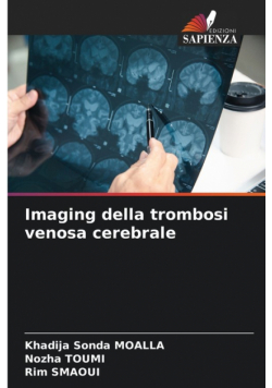 Imaging della trombosi venosa cerebrale