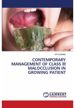 Contemporary Management Of Class Lll Malocclusion In Growing Patient