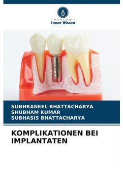 Komplikationen Bei Implantaten
