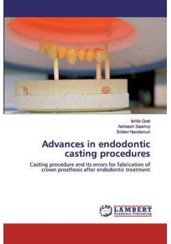 Advances in endodontic casting procedures