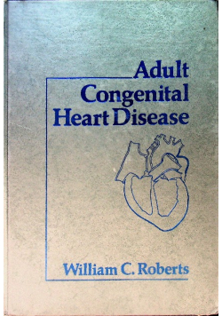 Adult Congenital Heart Disease