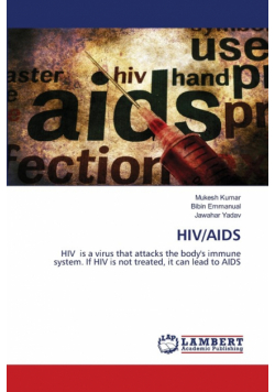 Hiv/aids