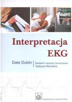 Interpretacja EKG