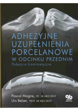 Adhezyjne uzupełnienia porcelanowe w odcinku przednim