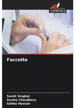 Faccette