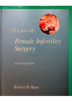 female Infertility Surgery