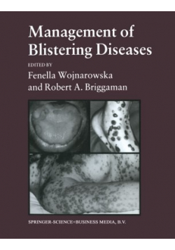 Management of Blistering Diseases