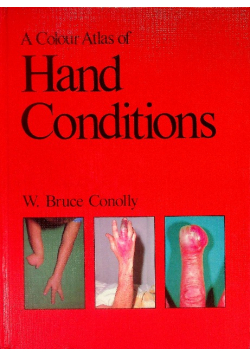 A Colour Atlas of Hand Conditions