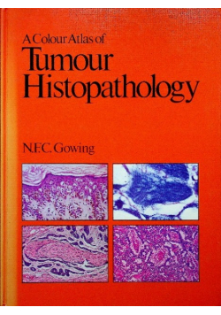 A Colour Atlas of Tumour Histopathology