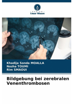 Bildgebung bei zerebralen Venenthrombosen