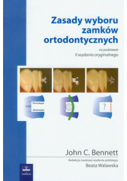Zasady wyboru zamków ortodontycznych