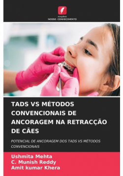 Tads Vs Métodos Convencionais De Ancoragem Na Retracção De Cães