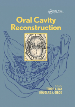 Oral Cavity Reconstruction