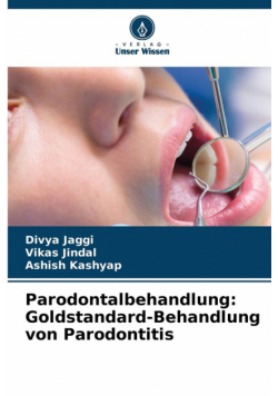 Parodontalbehandlung