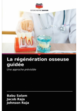 La régénération osseuse guidée