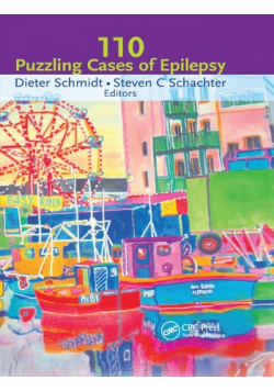 110 puzzling cases of epilepsy