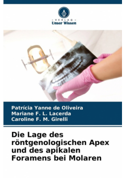 Die Lage des röntgenologischen Apex und des apikalen Foramens bei Molaren