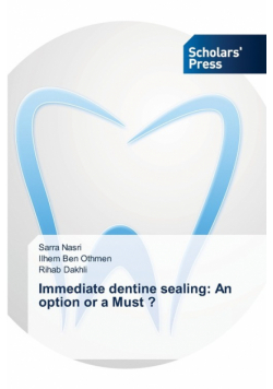 Immediate dentine sealing