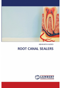 Root Canal Sealers
