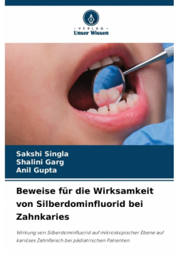 Beweise für die Wirksamkeit von Silberdominfluorid bei Zahnkaries