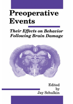 Preoperative Events