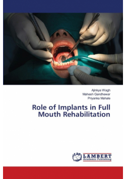 Role of Implants in Full Mouth Rehabilitation