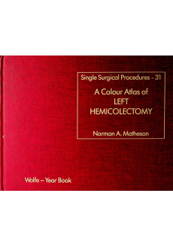 A colour Atlas of left hemicolectomy