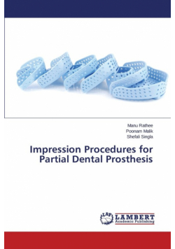 Impression Procedures for Partial Dental Prosthesis