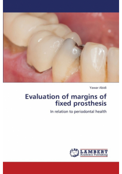 Evaluation of Margins of Fixed Prosthesis